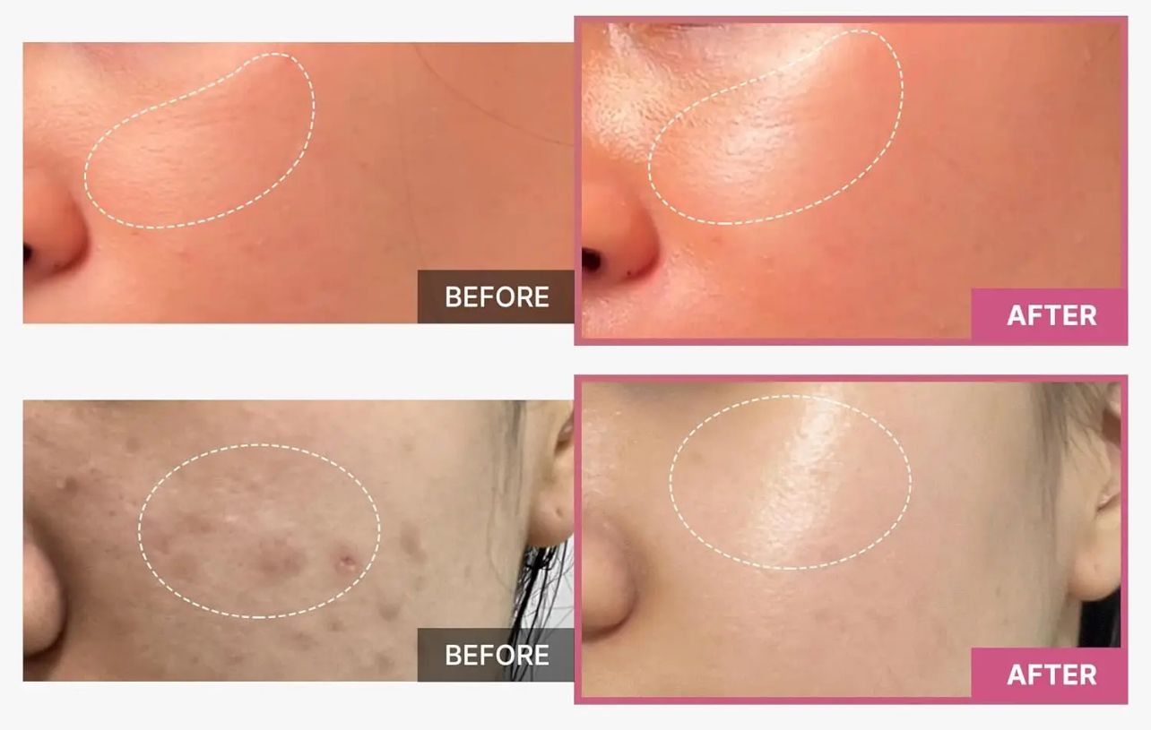 Kollagen-Gelee-Creme