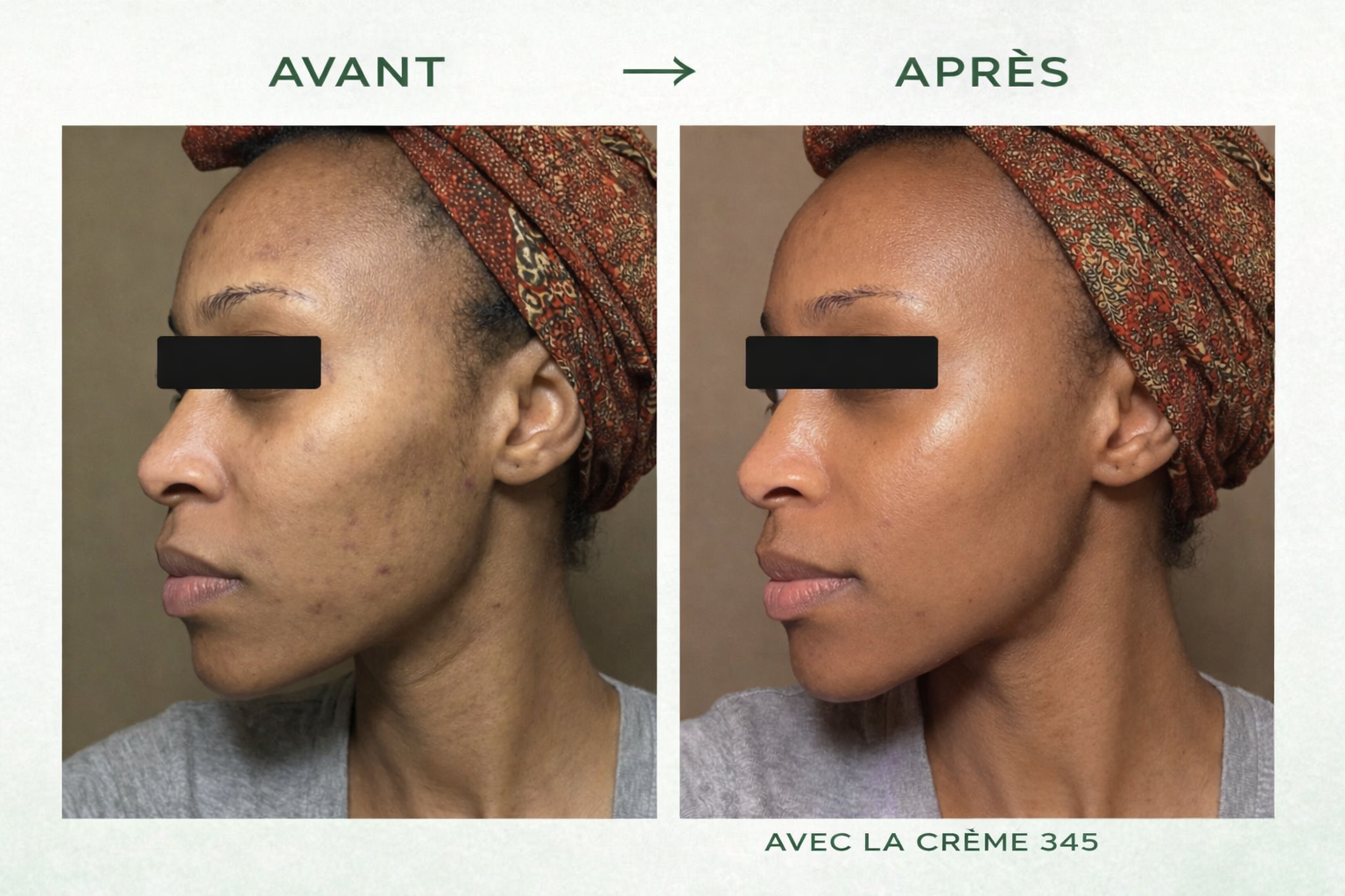 345 Lakerain Pflegecreme für raue Haut